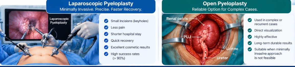 PYELOPLASTY LAP AND OPEN